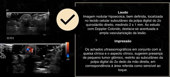 Slide com dois painéis de ultrassom à esquerda e, à direita, o texto do laudo com achado, medida e impressão diagnóstica