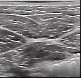 Quadro da aula: Anatomia da parede abdominal
