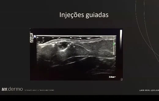 Quadro da aula: Apresentação e evolução do ultrassom