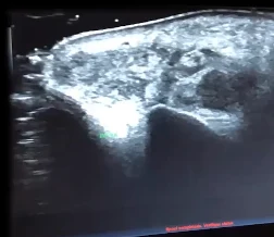 Quadro da aula: Abscesso estéril, com a Dra. Gabriela Munhoz